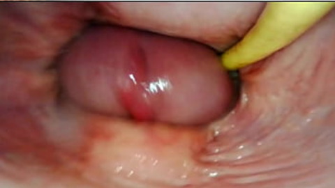 AMAZING INTERNAL POV. CAMERA INSIDE HER PUSSY WHILE I FILL HER WITH CUM