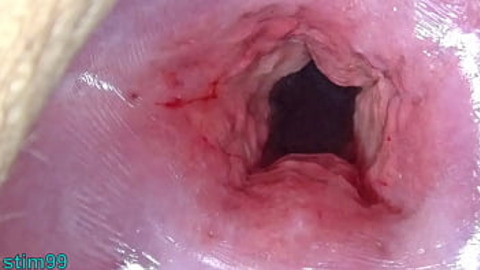 Japanese mom spreads her cervix wide —  inserting big objects into her open uterus