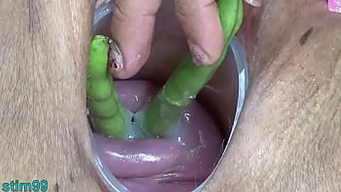 Kinky mature Asian lesbians fuck cervix prolapse and pee hole