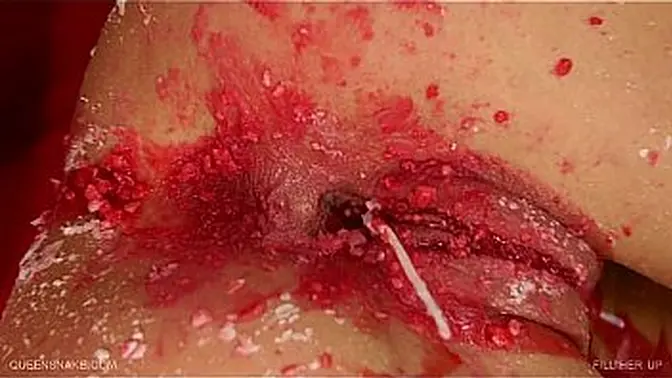 Dominant man fills submissive woman with candle wax during BDSM session