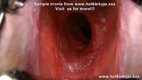 Scraping the depths of forbidden desire, 'HKJ' succumbs to unbridled rectal ravagement by gargantuan speculum & monstrous dildo