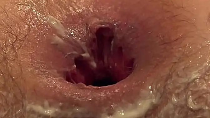 Russian chubby girl's hairy cunt and gaping butt get full anal fisting